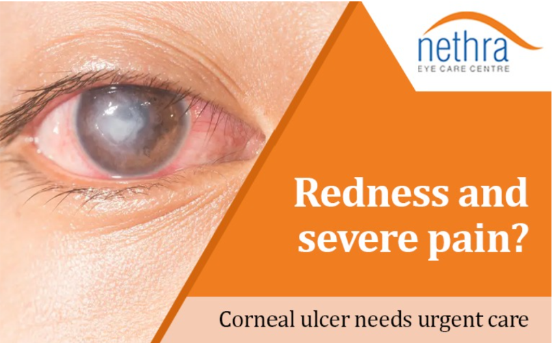 best eye hospital in kerela